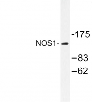 AP06622PU-N - NOS1