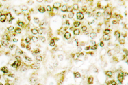 AP06624PU-N - SMAD1