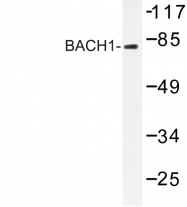 AP06634PU-N - BACH1