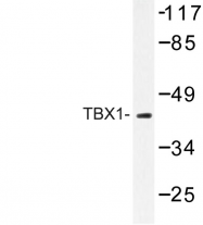 AP06637PU-N - TBX1
