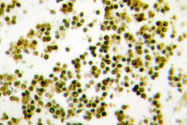 AP06642PU-N - Musculin