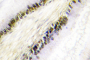 AP06664PU-N - NR2F6