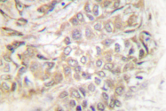 AP06666PU-N - TPT1 / TCTP