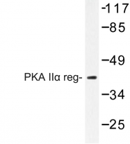 AP06667PU-N - PRKAR2A