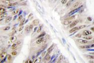 AP06669PU-N - hnRNP-L / HNRNPL
