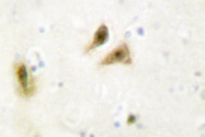 AP06673PU-N - UBTF / UBF