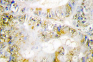 AP06683PU-N - Catenin beta-1