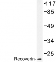 AP06684PU-N - Recoverin