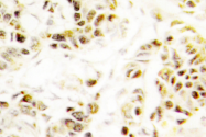AP06687PU-N - FEN1 / RAD2