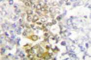 AP06696PU-N - CSNK1A1