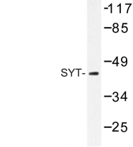 AP06736PU-N - Synaptotagmin-1