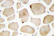 AP06739PU-N - MAPKAP Kinase-3