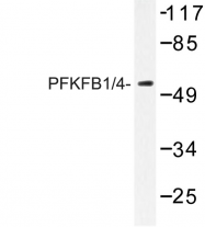 AP06742PU-N - PFKFB1/4
