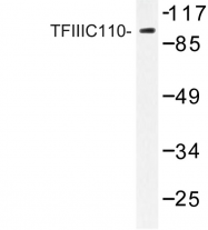 AP06745PU-N - GTF3C2 / TFIIIC110