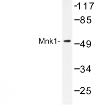 AP06753PU-N - MKNK1