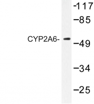 AP06774PU-N - CYP2A6