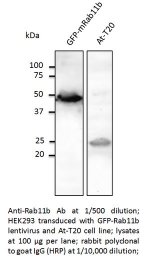 AB0082-200 - RAB11B