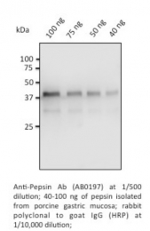 AB0197-200 - Pepsin