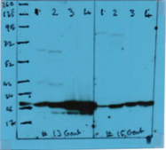 AB3035-500 - pan RAB11