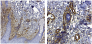 AF5910 - Collagen type IV