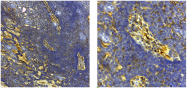 AF5910 - Collagen type IV
