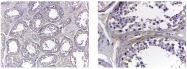 AF6210 - Collagen type VI