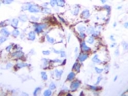 AM01369PU-N - TGFB1