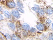AM01369PU-N - TGFB1