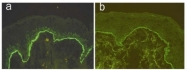 AM02250PU-S - Collagen type XVII alpha 1 chain