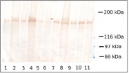 AM02250PU-S - Collagen type XVII alpha 1 chain