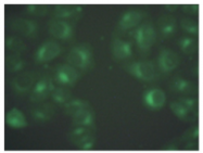 AM02302PU-N - Beta-2-microglobulin