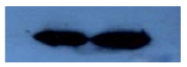 AM02303PU-N - Beta-2-microglobulin