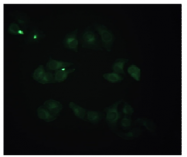 AM02303PU-N - Beta-2-microglobulin