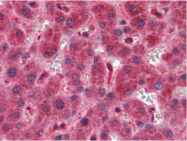 AM05382PU-N - TIMP2
