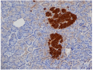 AM05475PU-N - Insulin