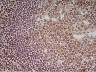 AM05527PU-T - CD70