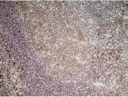 AM05527PU-T - CD70