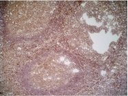 AM05527PU-T - CD70