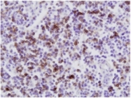 AM05901PU-S - CD8