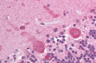 AM06001PU-N - AKT3 / PKB gamma