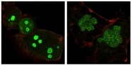 AM06071SU-N - Nucleophosmin