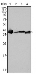 AM06071SU-N - Nucleophosmin