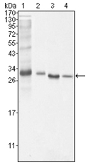 AM06073PU-N - Bcl-10