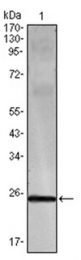 AM06079PU-N - IFNG / Interferon gamma