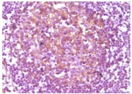 AM06089PU-N - CD14