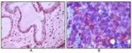 AM06091PU-N - CD10 / Neprilysin