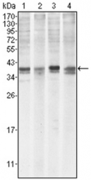 AM06096PU-N - MCL1