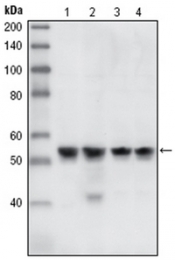 AM06099PU-N - CHK1