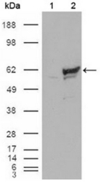 AM06099PU-N - CHK1