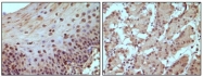 AM06100SU-N - Retinoblastoma-associated protein / RB1